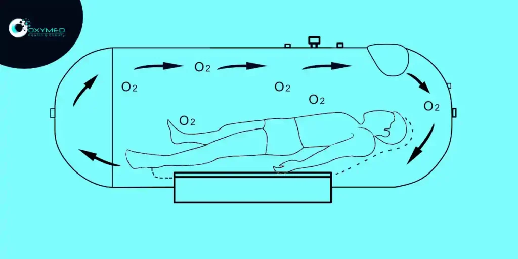 Characteristics-of-a-portable-hyperbaric-oxygen-chamber-img